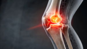 Jak rozpoznac uszkodzenie lakotki objawy i badania diagnostyczne LIFE